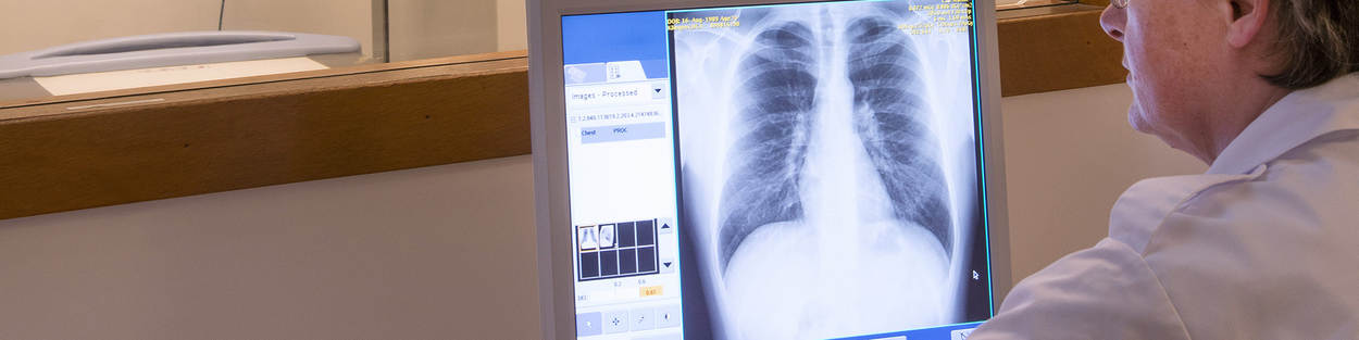 Röntgenfoto van longen.